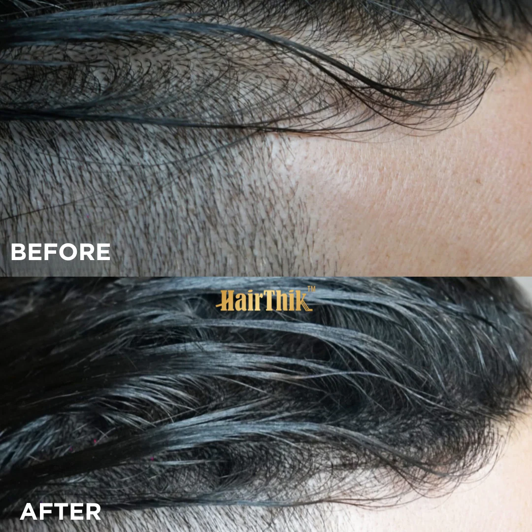 HairThik Hair Fibers - 15 grams - Image 9